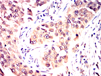 CRTC3 Antibody