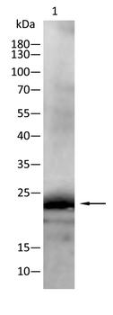 KLRD1 Antibody
