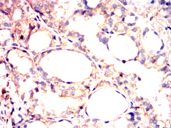 BID Antibody