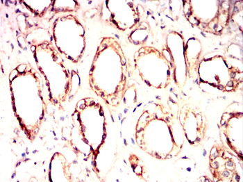 GRK2 Antibody
