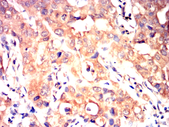 GRK2 Antibody