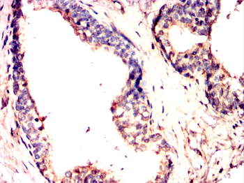 GRK2 Antibody
