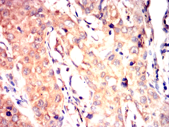 PODXL Antibody