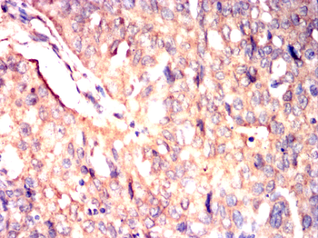 PODXL Antibody