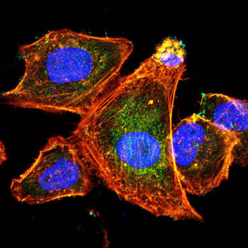 FCSK Antibody
