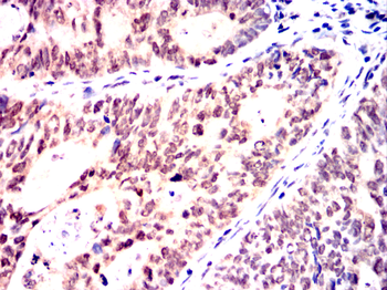 CDK9 Antibody