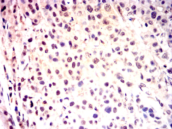 CDK9 Antibody