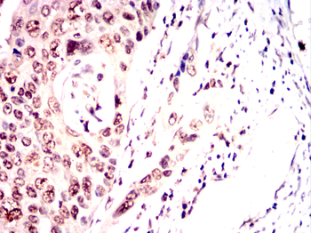 CDK9 Antibody