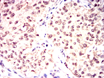 CDK9 Antibody