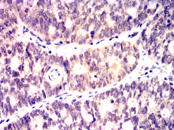FYN Antibody