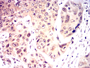 FYN Antibody
