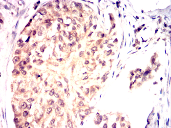 FYN Antibody