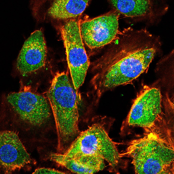 BLNK Antibody