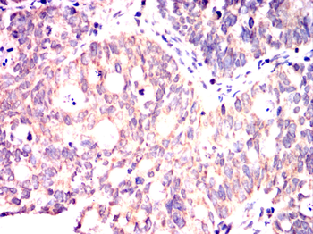 EIF2AK3 Antibody