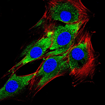 LATS1 Antibody