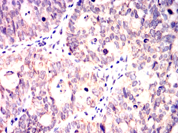 LATS1 Antibody