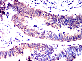 LATS1 Antibody