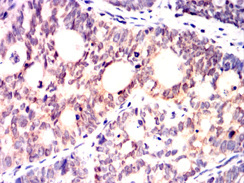 ENO1 Antibody