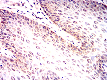 ENO1 Antibody
