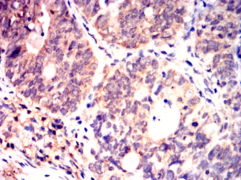 PDK1 Antibody