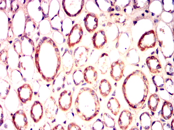 PDK1 Antibody