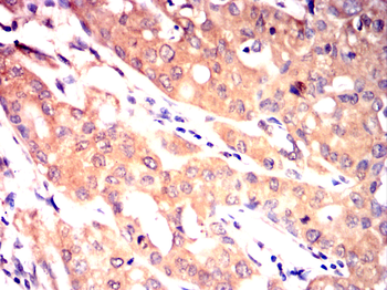 PDK1 Antibody