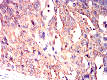 PDK1 Antibody