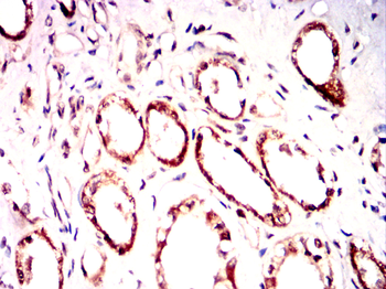 XRCC5 Antibody