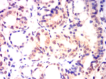 XRCC5 Antibody