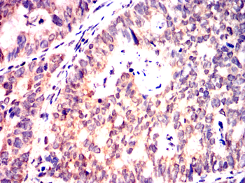 SMN1 Antibody