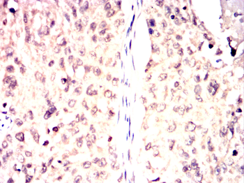 SMN1 Antibody