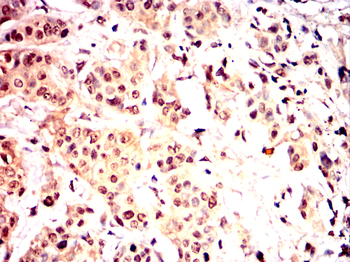 SMN1 Antibody