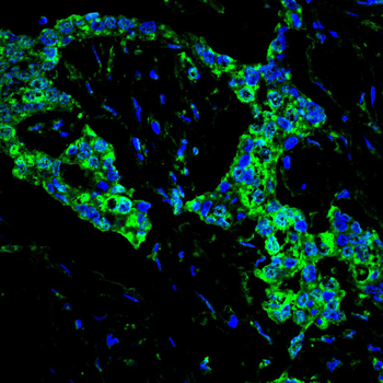 SMN1 Antibody