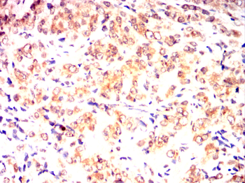 SMN1 Antibody