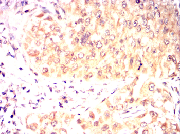 SMN1 Antibody