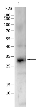 SMN1 Antibody