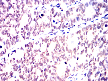 MSH2 Antibody