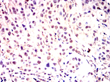 MSH2 Antibody