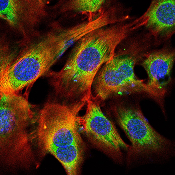 PINK1 Antibody