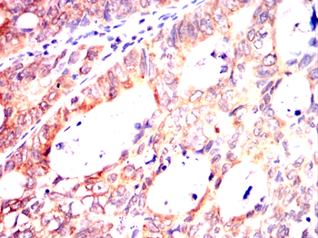 PINK1 Antibody