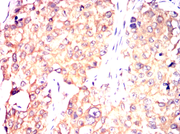 PINK1 Antibody