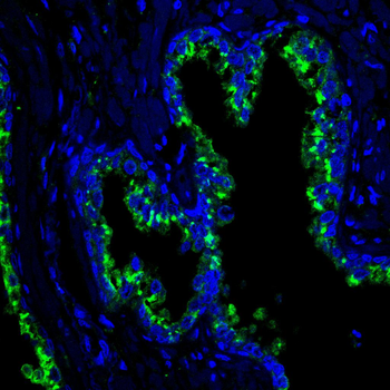 PINK1 Antibody