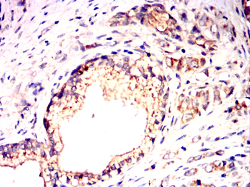 PINK1 Antibody