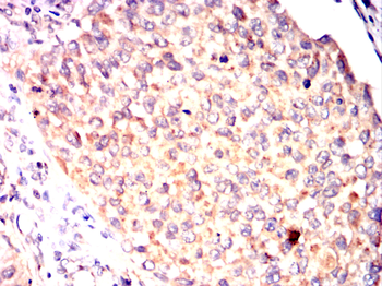PINK1 Antibody