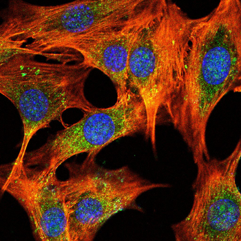 TYR Antibody