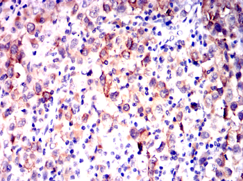 TYR Antibody