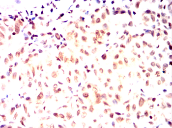 TYR Antibody