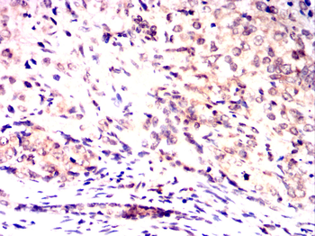 TYR Antibody