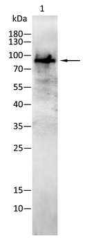 TYR Antibody
