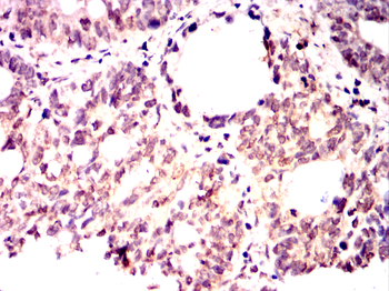HMGCR Antibody